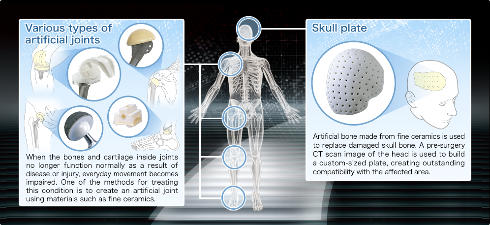 figure:Fine Ceramics Inside the Body