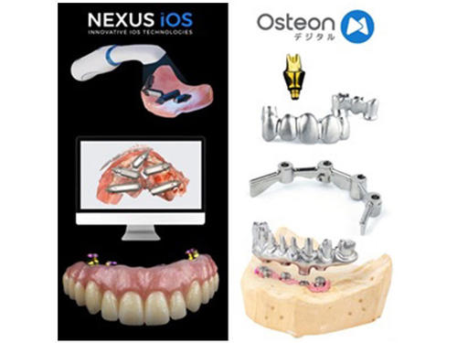Collaboration with Osteon Digital Japan Co., Ltd.