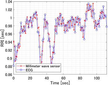 Photo: Heart rate interval (RRI)