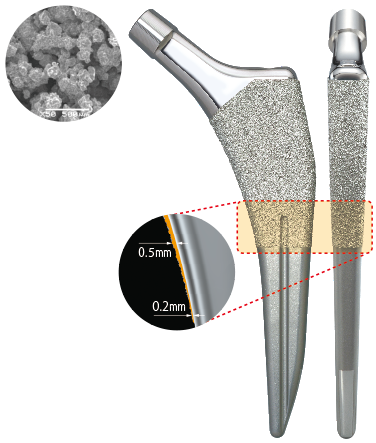Surface Treatment Technology