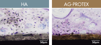 Figure：HA, AG-PROTEX